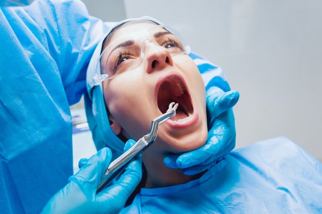 Tooth Extraction in ahmedabad