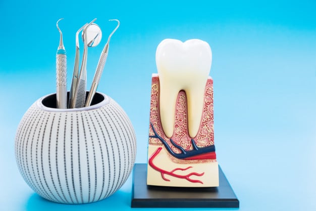 root canal treatment in ahmedabad