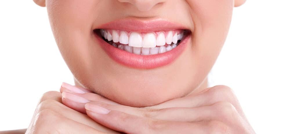 smile makeover in ahmedabad